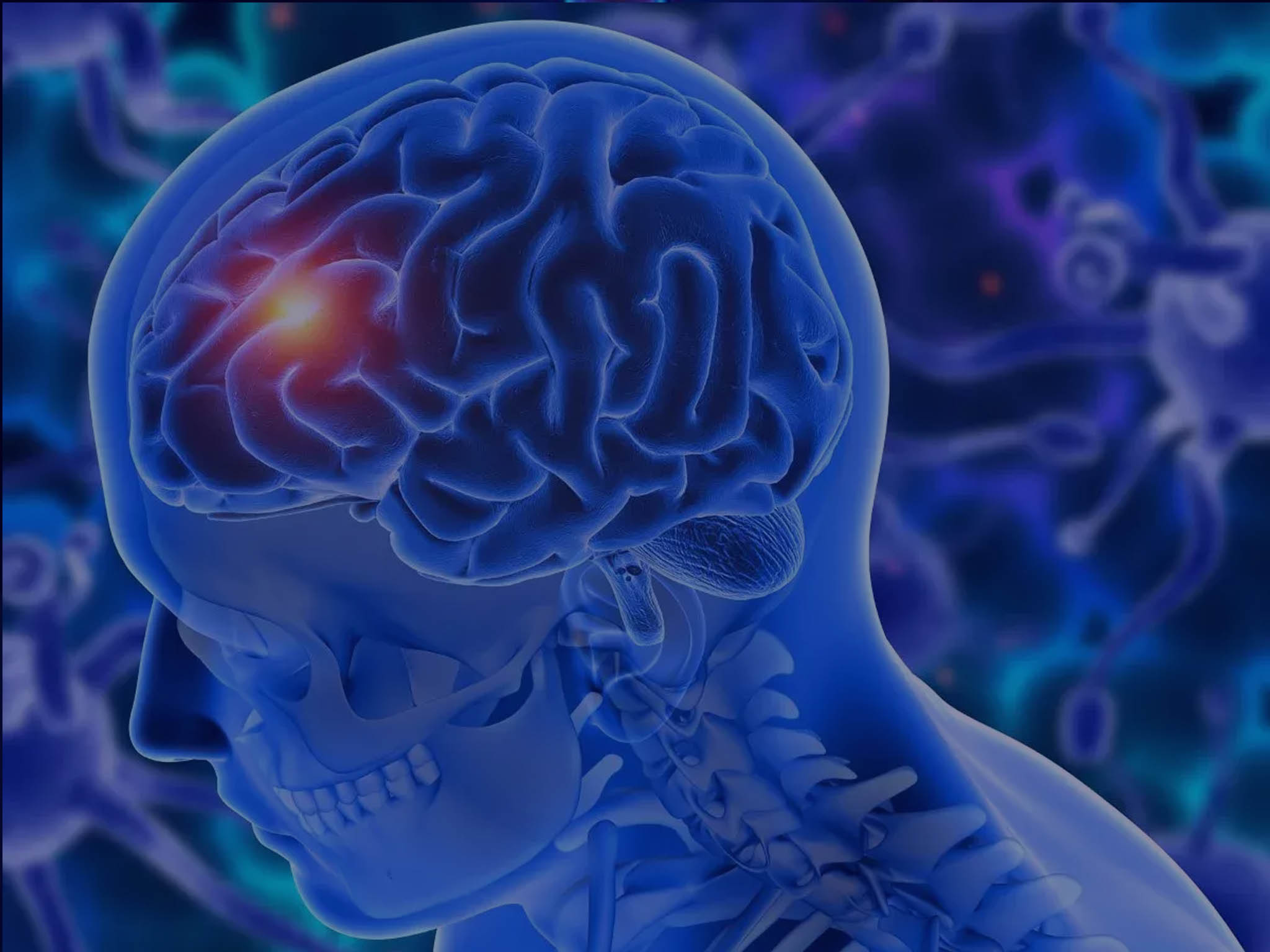 Brain Tumours Surgery in Jalandhar