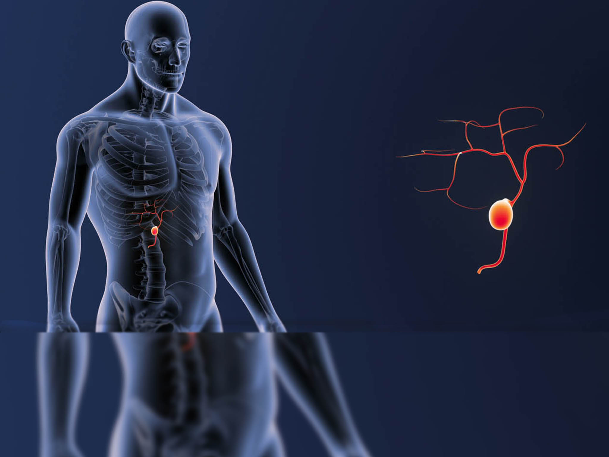 Brain Tumours Surgery in Jalandhar