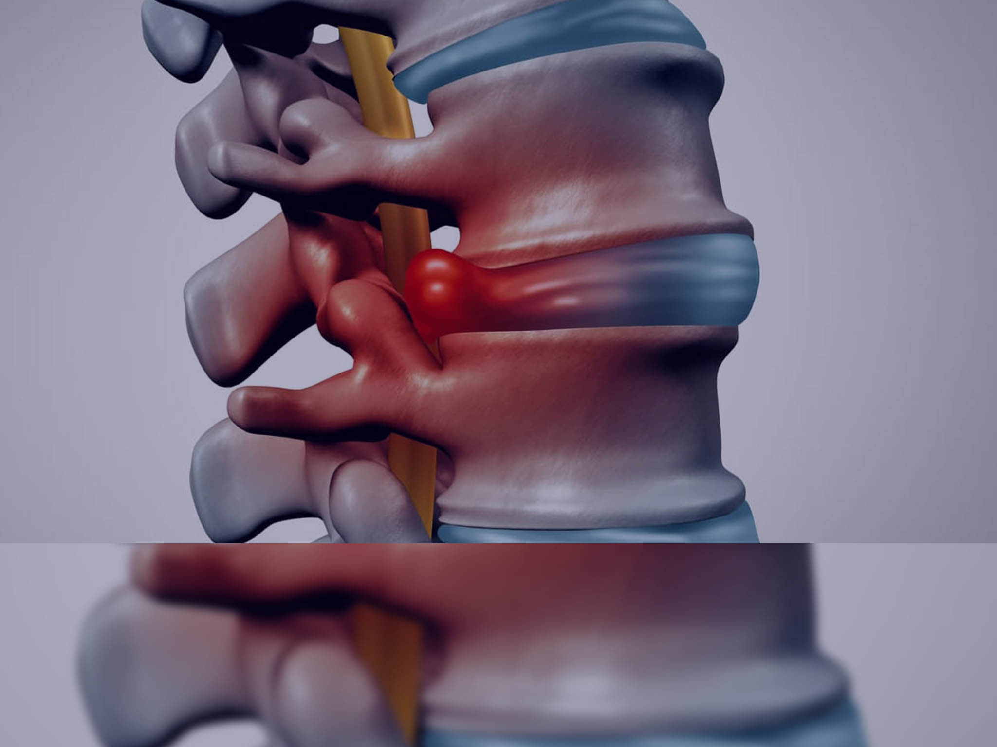 Brain Tumours Surgery in Jalandhar