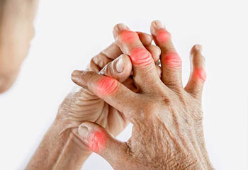 arthritis hospital in jalandhar
