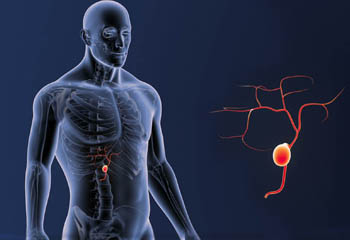 Laparoscopy of Gall Bladder, Appendix doctor in jalandhar