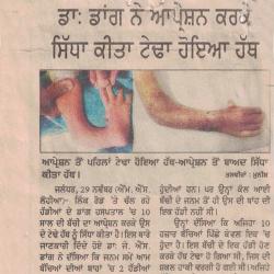 Successful results of Hand and wrist surgery
